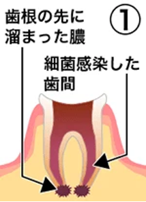 治療の流れ01